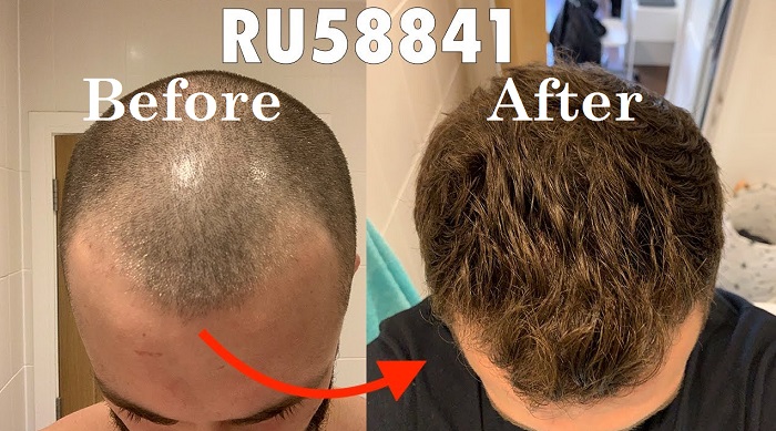 ru58841-before-and-after