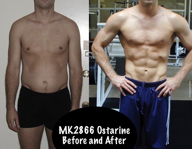 MK-2866 Ostarine Before and After Result